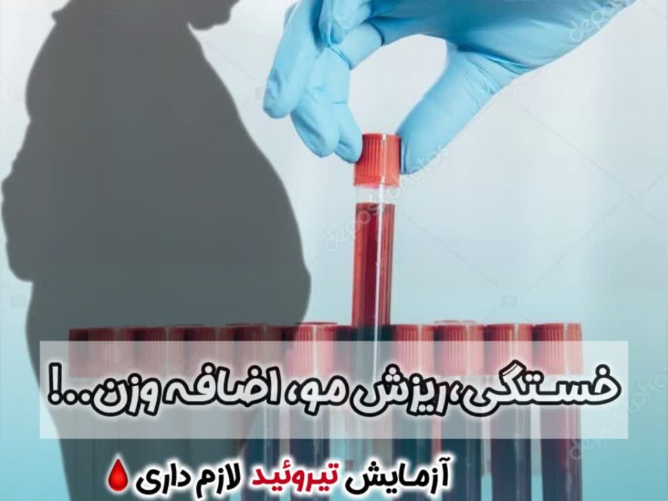 آزمایش_تیروئید