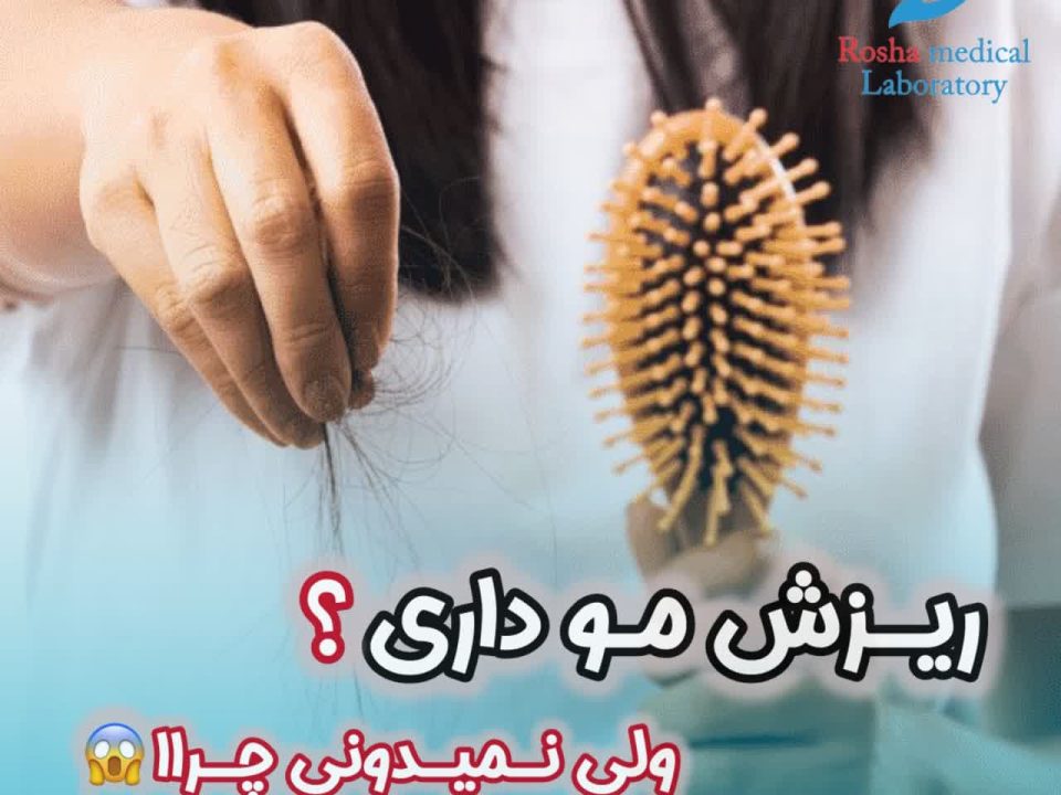 ریزش مو و آزمایش های بررسی آن